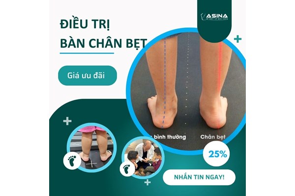 LOẠT NGUY CƠ TIỀM ẨN KHI TRẺ BỊ BÀN CHÂN BẸT