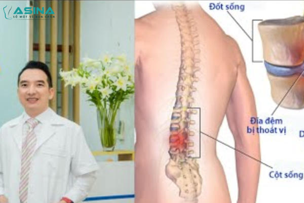 Thoát vị đĩa đệm - góc nhìn và đánh giá đa chiều